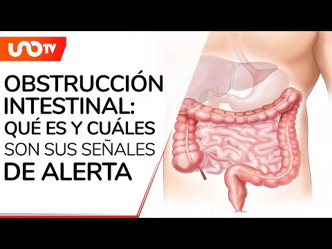 Consejos para tratar una obstrucción intestinal en pequeños mamíferos.